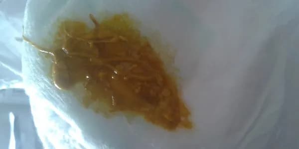 Śluz w kupie niemowlaka: co oznacza i kiedy to niepokojący objaw? Śluz w kupie niemowlaka: co oznacza i kiedy to niepokojący objaw?