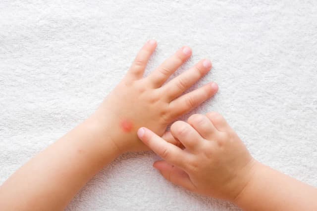 Skuteczne sposoby na kleszcze dla niemowlaka - bezpieczne repelenty Skuteczne sposoby na kleszcze dla niemowlaka - bezpieczne repelenty