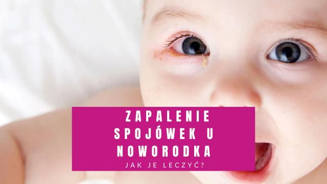 Co na zapalenie spojówek u niemowlaka - objawy, leczenie i profilaktyka Co na zapalenie spojówek u niemowlaka - objawy, leczenie i profilaktyka